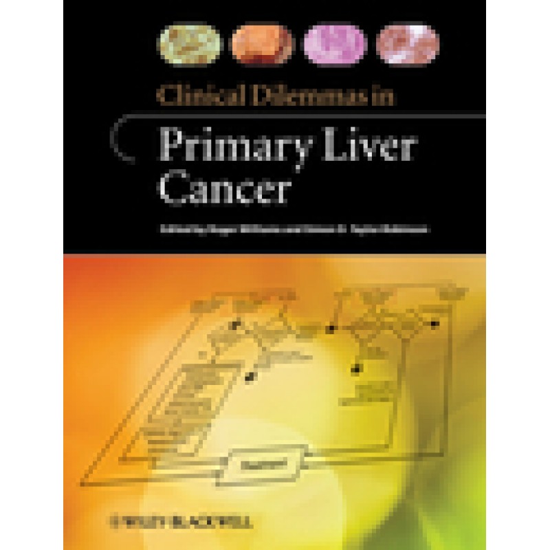 Clinical Dilemmas in Primary Liver Cancer